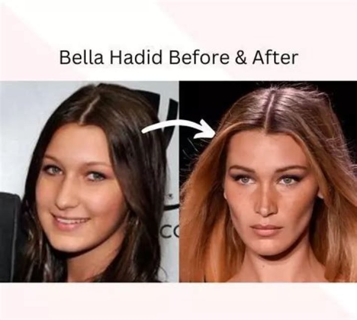 Transformation Journey: Before And After Bella Hadid