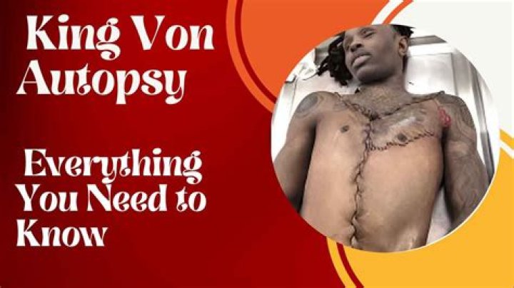 Unraveling The Mystery: The Dayvon Daquan Bennett Autopsy